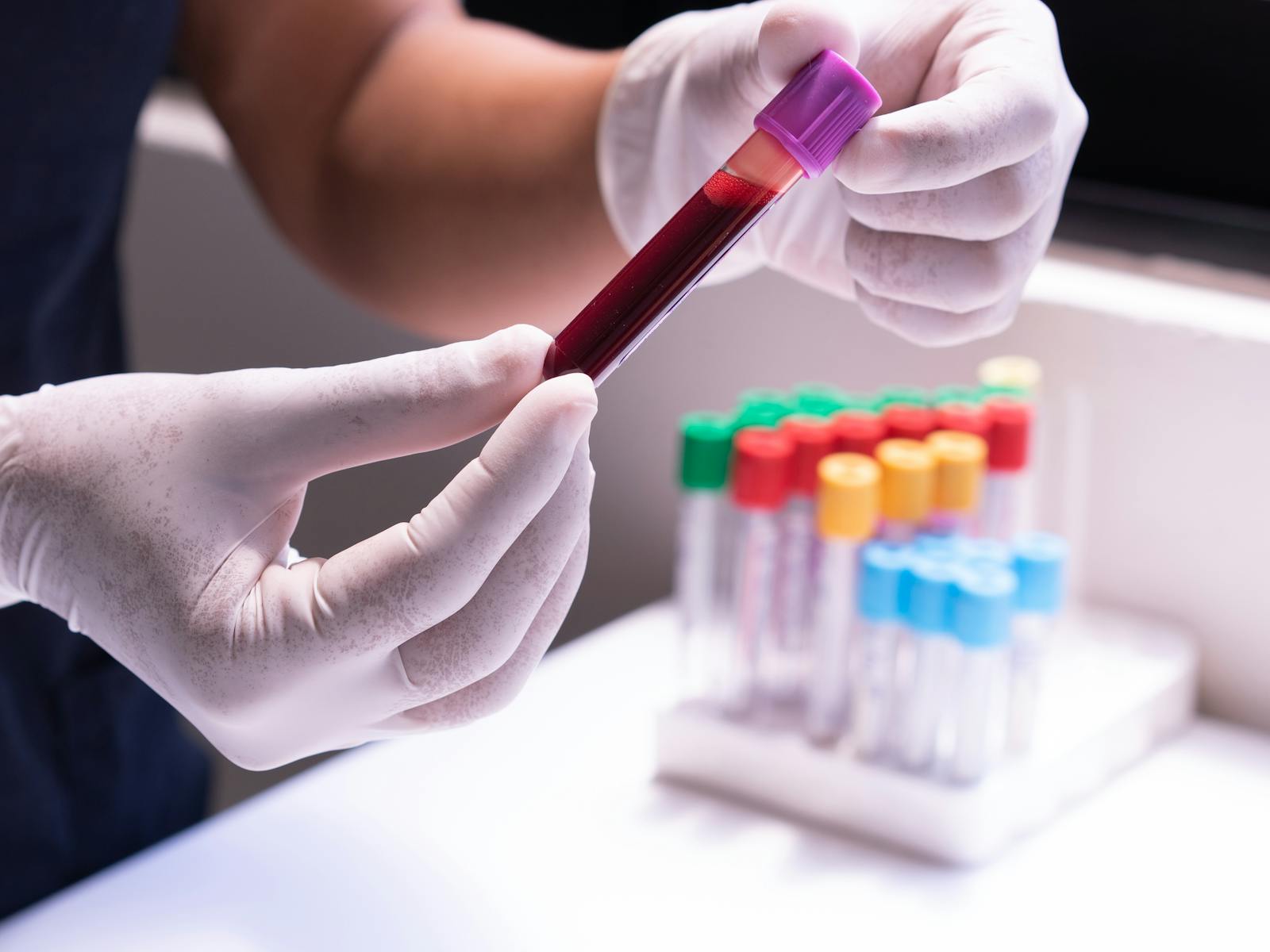 Reagenzgläser mit Blutprobe – Vorbereitung der Laboranalyse