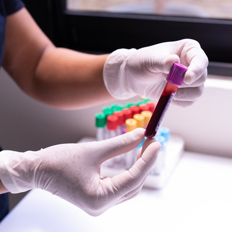 Behandschuhte Hände halten ein Reagenzglas mit Blutprobe für die Laboranalyse