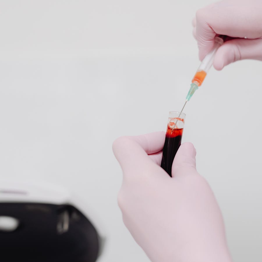 Labormitarbeiterin bei der Blutanalyse